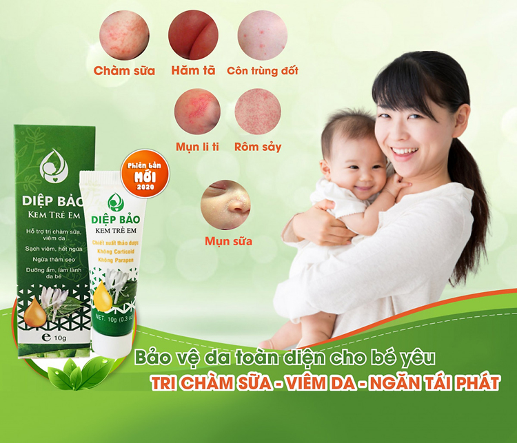 Hình ảnh quảng cáo sản phẩm “Diệp Bảo - Kem trẻ em” được đăng tải tràn lan trên mạng.