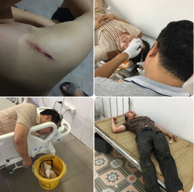 ông Vạn cùng con trai tên Nguyễn Chí Thành (bị bệnh tâm thần phân liệt) bị hành hung, gây thương tích ngày 01/11/2020 ( ảnh do gia đình ông vạn cung cấp)