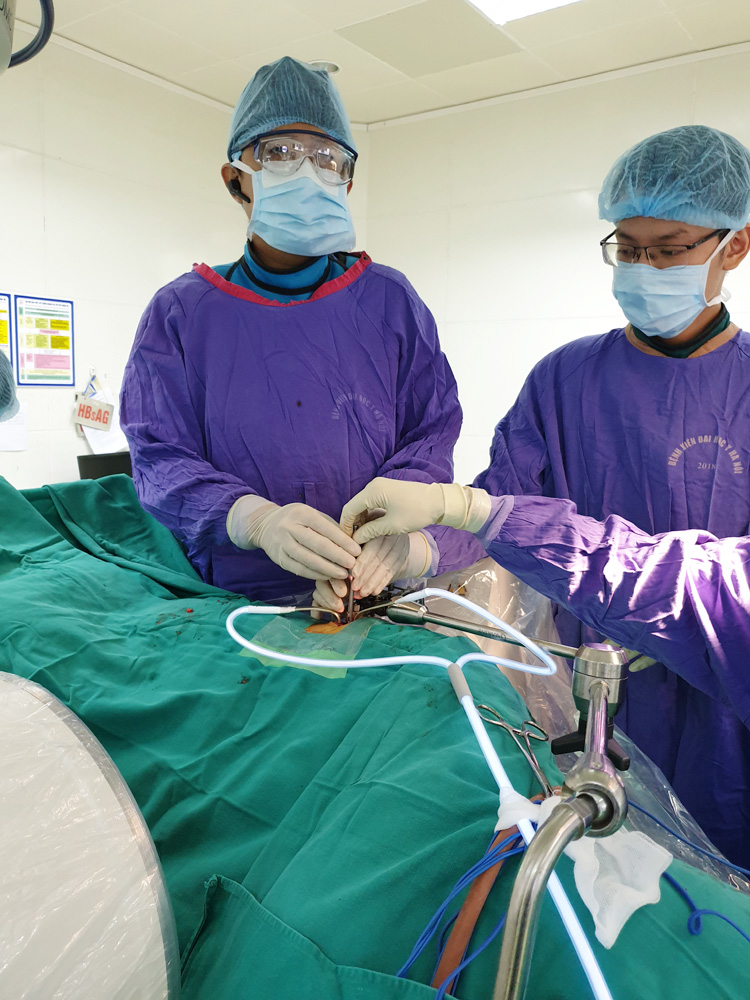 TS.BS Nguyễn Vũ và cộng sự thực hiện phẫu thuật cột sống ít xâm lấn lối bên XLIF.
