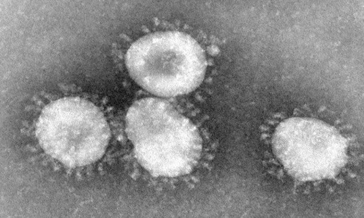 Virus corona quan sát qua kính hiển vi điện tử. (Ảnh: National Geographic).