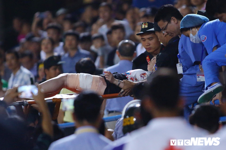 Nữ cổ động viên bị pháo sáng rơi trúng đùi khi đang theo dõi trận đấu trên sân Hàng Đẫy. (Ảnh: Ngọc Anh)