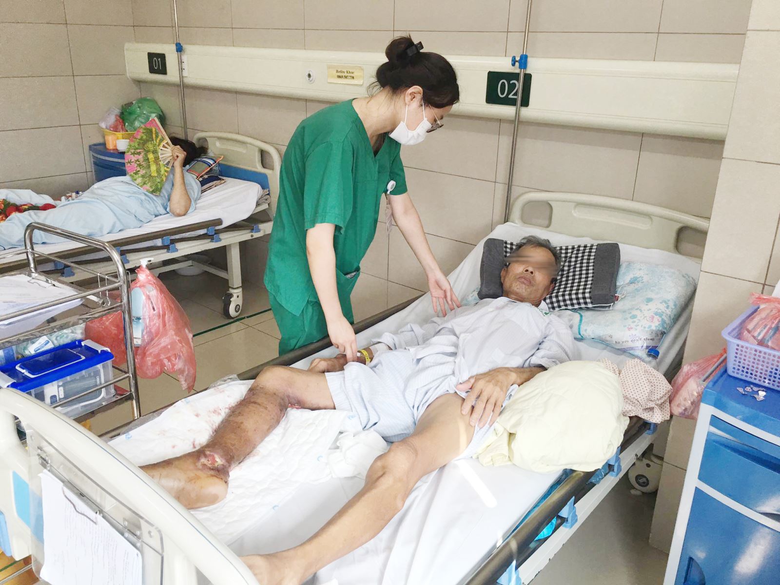 Sau hơn 1 tháng điều trị tích cực tại BV Bạch Mai, ông Lưu Công C vẫn tiếp tục điều trị để chờ ghép da.