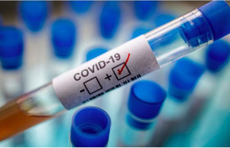 Xét nghiệm là biện pháp duy nhất phát hiện nhiễm Covid-19. (Ảnh: Getty Images)