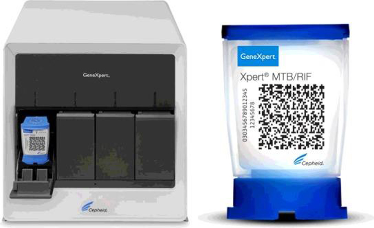 Xét nghiệm Gene Xpert được hy vọng là phương pháp mới bổ sung vào các phương pháp xét nghiệm Covid-19 hiện nay.
