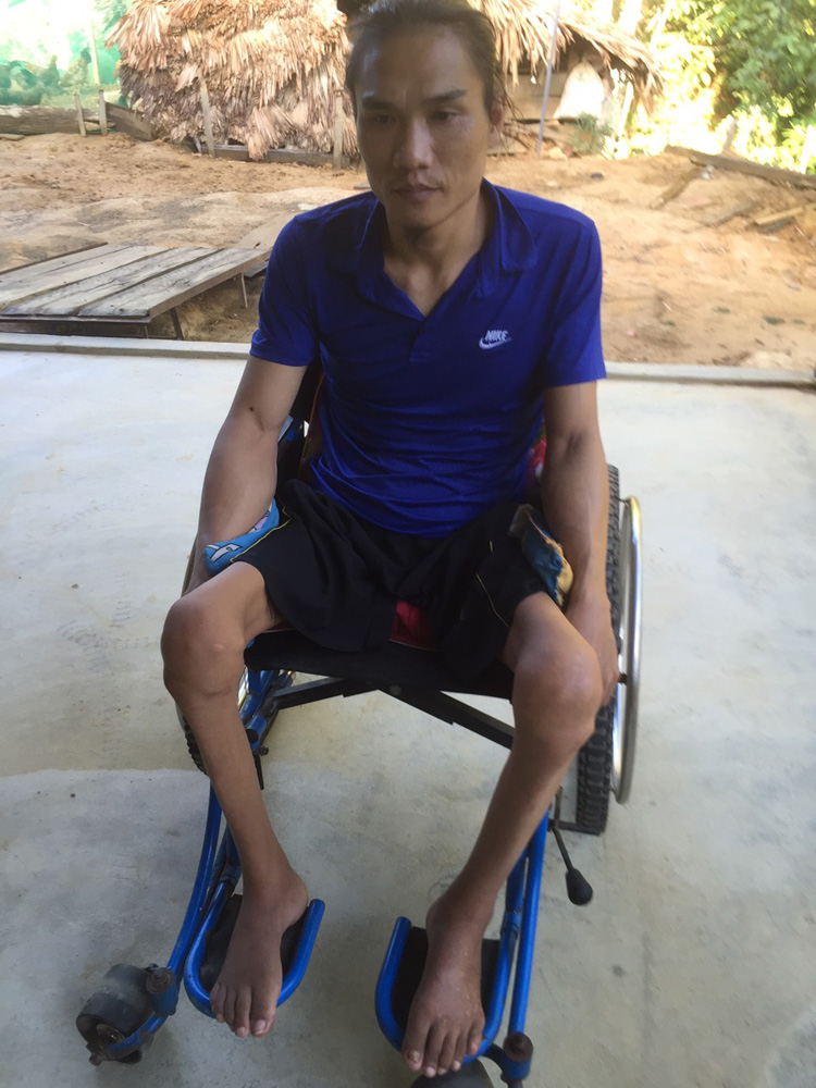 Anh Thái Khắc Trọng sinh năm 1985 bị gãy đốt sống, đứt tủy xương sống không đi lại được.