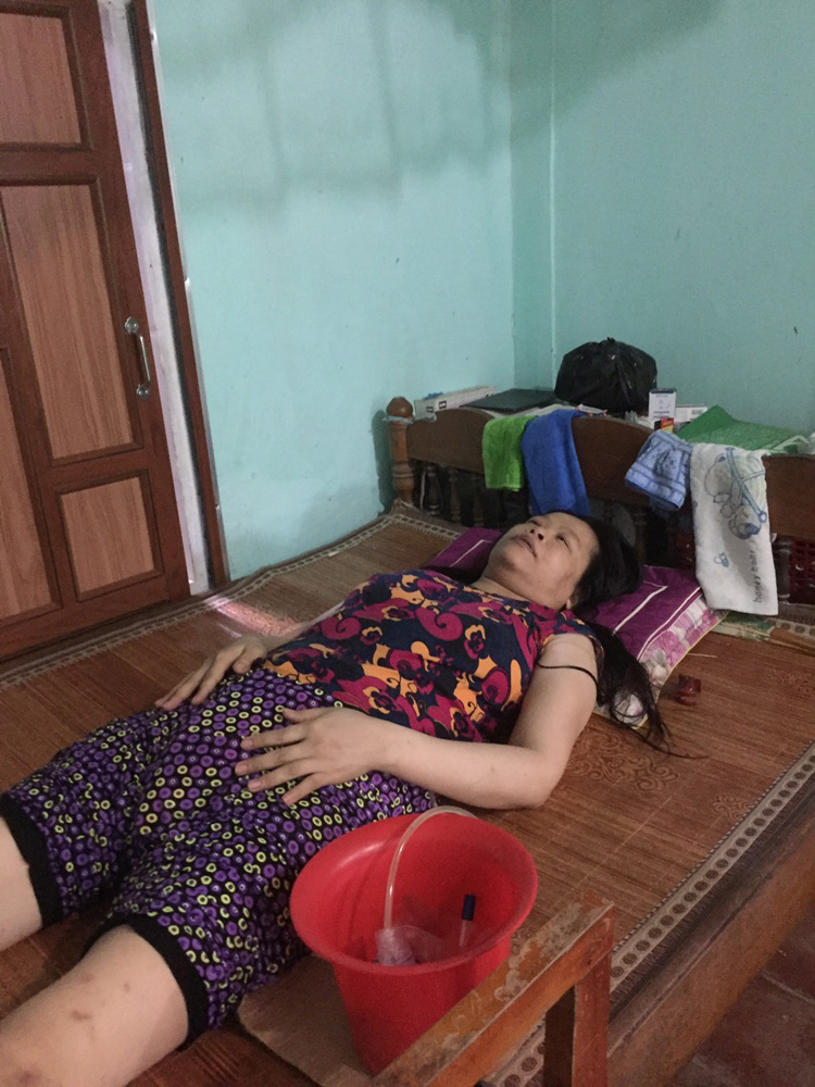 Chị Nguyễn Thị Hành, sinh năm 1976 bị đập tủy xương sống, nằm liệt giường.