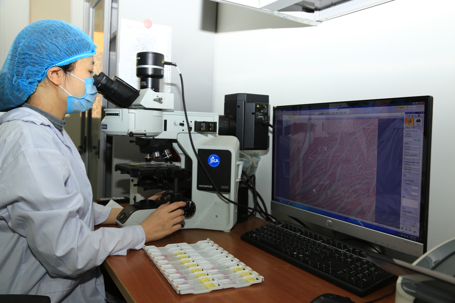Kiểm tra tiêu bản bệnh học tại Phòng giải phẫu và kỹ thuật vi sinh của Trung tâm Polyvac.