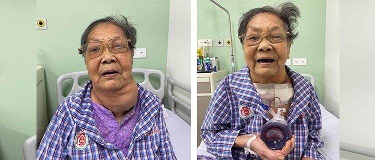 Bà Trần Thị Bé trước và sau khi mổ